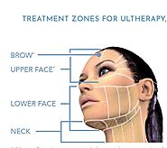 Ultherapy in Richmond | Anti Ageing Treatment in Richmond