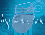 The Impact of Pacemaker Devices in the Health Sector