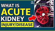 What is Acute Kidney Injury (AKI) | Acute Kidney Injury Causes | AKI vs CKD