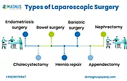 Laparoscopic Surgery In Chennai | 100% Best Treatment