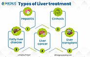 Best Liver Doctor in Chennai