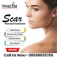 Never get those scar ever again with Twacha Aesthetic Clinic