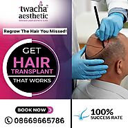 Get Rid Of Baldness Hair Problems Solution - Twacha Aesthetic Clinic