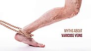 Top 11 Myths About Vein Diseases?