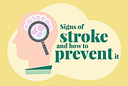 How to Prevent the Sign of Stroke?