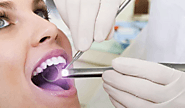Oral Cancer Screening in Toronto | Best Oral Cancer Screening