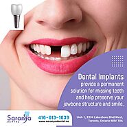 Dental Implants in Toronto | Toronto Dental Implants