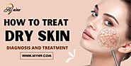 How to treat Dry Skin: Diagnosis and Treatment - Hi9 Blogs – Myhinine
