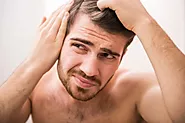 Hair Loss: Symptoms and Its Causes