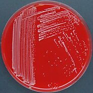 Rhodococcus equi