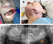 https://www.ncbi.nlm.nih.gov/pmc/articles/PMC4094581/