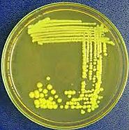 The incredible yellow Flavourbacterium streptomyces sp carotenoids!