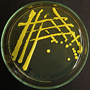 Bright Yellow Micrococcus luteus