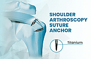 Advancements in Arthroscopy Shoulder Implants