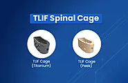 TLIF Spinal Cage: Overview, Benefits,and Applications