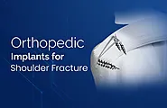 Shoulder Fracture : Overview, Types and Implants - Zealmax Innovations Pvt Ltd