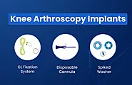 What is Knee Arthroscopy: Causes, Need & Implants - Zealmax Innovations Pvt Ltd