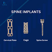 Spine Implants Manufacturer and Exporter | Zealmax Ortho