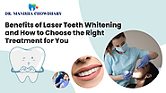 Benefits of Laser Teeth Whitening and How to Choose the Right Treatment for You – Best dentist in Faridabad