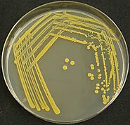 Gold, an attractive color Gold , strains of Staphylococcus Aureus produces a staphyloxonthin catarenoid pigment.