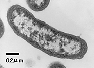 Micrograph of the Paracoccus carotinifaciens bacterium.