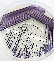 Chromobacterium Violacein