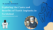 Exploring the Costs and Benefits of Tooth Implants in Faridabad – Best dentist in Faridabad