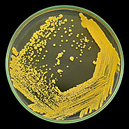 Image of Micrococcus luteus colonies