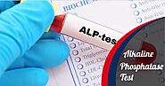 Alkaline Phosphatase Levels, Discover 8 Causes Of High ALP