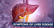 Symtoms Of Liver Disease