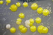 A bright yellow Micrococcus luteus