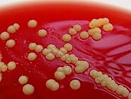 MICROCOCCUS LUTEUS AS A CAUSE OF RECURRENT BACTEREMIA : The Pediatric Infectious Disease Journal