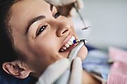 Achieve a Sparkling Smile with Expert Teeth Cleaning in Oakville