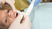 Common Fluoride Dental Treatment Procedures