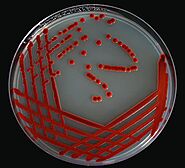 Serratia Marcescens