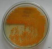 Brown Zeaxanthin pigment