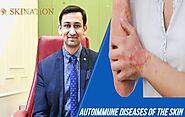   Skin Autoimmune Disorders Guide By Skin Expert – Skination Clinic