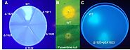 Pyoverdine: characteristics of fluorescent bacterial pigment