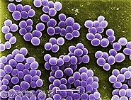 S. Aureus under the microscope.
