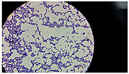 Lactic acid bacteria (LAB)