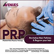 PRP Hair Loss Treatment Therapy in Ahmedabad.