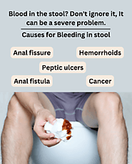 Causes for Bleeding in stool