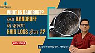 What is Dandruff | क्या Dandruff के कारण hair loss होता है | Hair Transplant Surgeon in Delhi