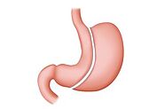 Is Gastric Bypass Surgery Safe?