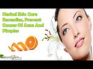 Herbal Skin Care Remedies, Prevent Causes Of Acne And Pimples