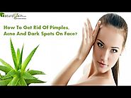How To Get Rid Of Pimples, Acne And Dark Spots On Face?