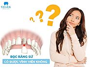 Bọc răng sứ có được vĩnh viễn không? Thời gian bao lâu?