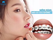 Niềng răng mũi có cao lên không? Khuôn mặt thay đổi ra sao?