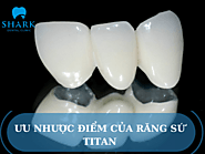 Thông tin về ưu nhược điểm của răng sứ Titan mà bạn nên biết