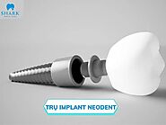 Trụ Implant Neodent có gì nổi bật? Xuất xứ, giá cả ra sao?